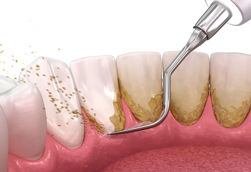 プロフェッショナルケア