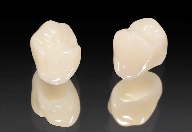 オールセラミックスクラウン