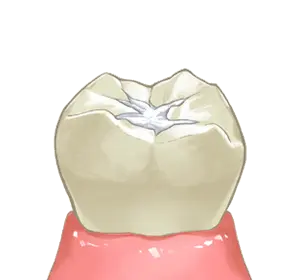 シーラント完了