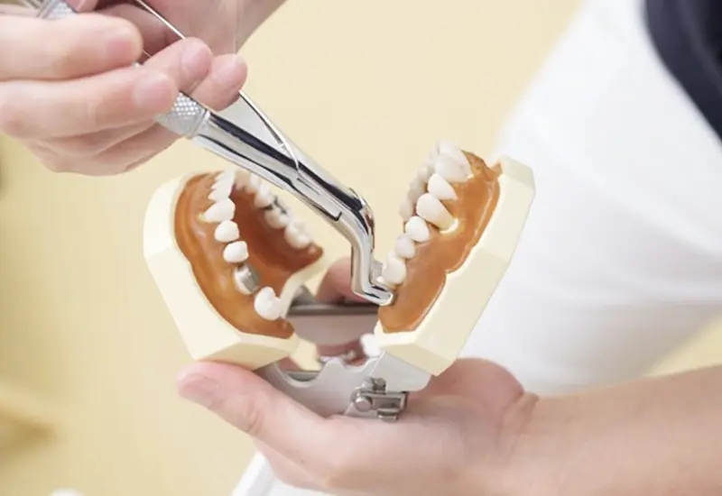 親知らずの抜歯